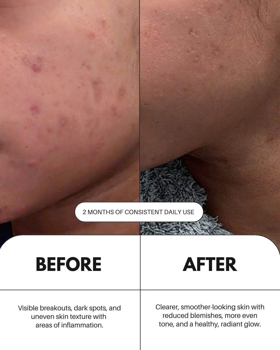 Sérum à la vitamine C pour le visage - Image 4