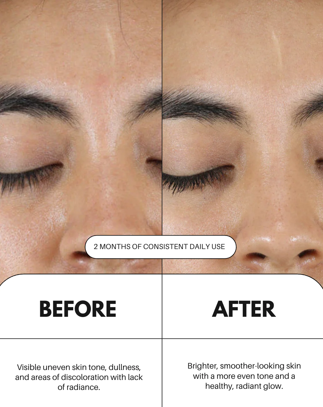 Sérum à la vitamine C pour le visage - Image 5